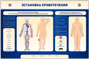 Электрифицированный стенд-тренажер "Остановка кровотечения" - fgospostavki.ru - Санкт-Петербург